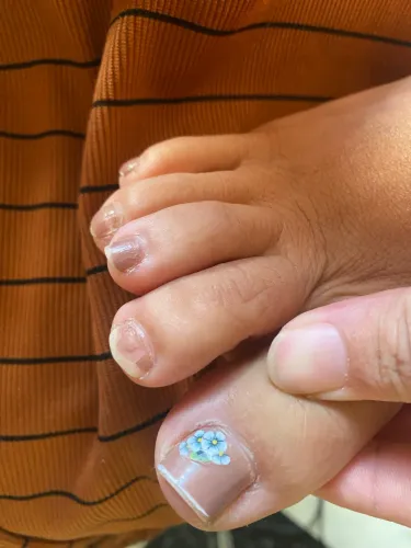Esmaltas em gel