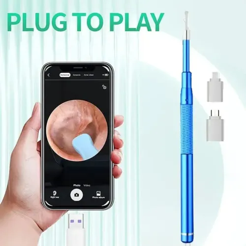 Otoscópio para Smartphone Android com câmera de inspeção com iluminação