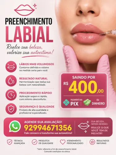 PREENCHIMENTO LABIAL 