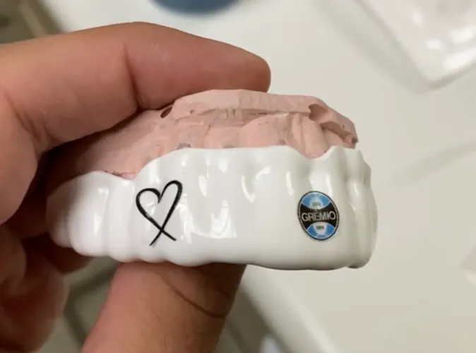 Protetor Bucal Personalizado - Feito por Dentista