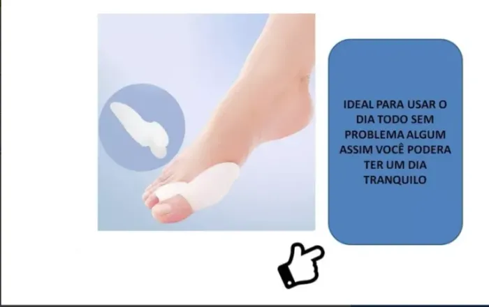 1 PAR PROTETOR DE JOANETE EM SILICONE - CONFORTO IMEDIATO 