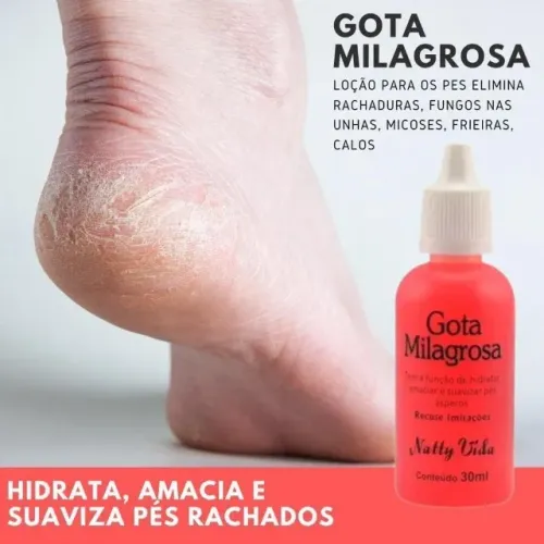 Hidratante Gota Milagrosa kit 5 unidades para pés e mãos cotovelos antirrachadura hidrata