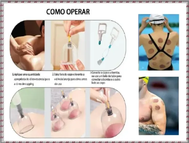 Kit de 24 copos de ventosas para ventosaterapia