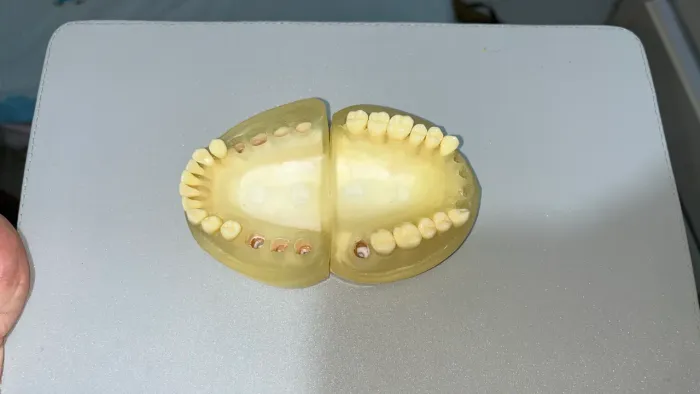 Refil de Periodontia PRONEW (Gengiva + alguns dentes)