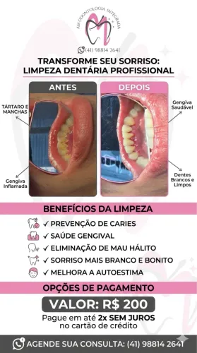 Limpeza dental