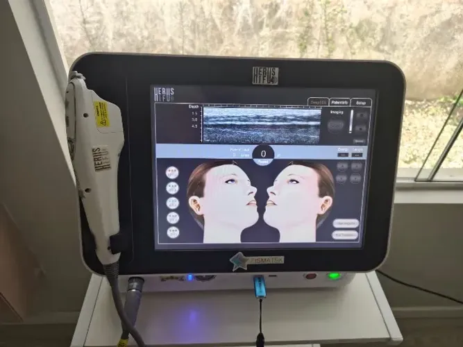  Ultrassom Microfocado Medical San + Todas as Ponteiras | Excelente Estado