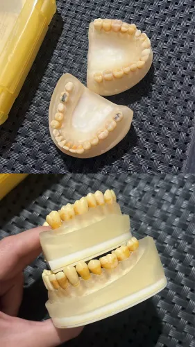 Refil manequim periodontia pronew