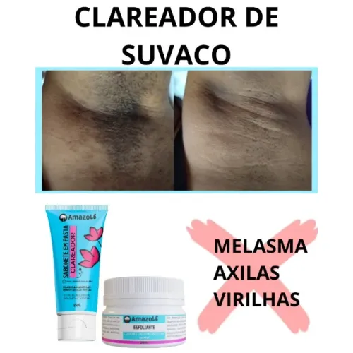 Clareador de Manchas de pele - PAGUE SÓ NA ENTREGA