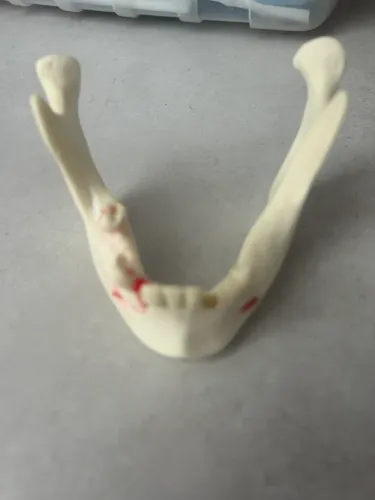 Manequim Implante - odontologia 