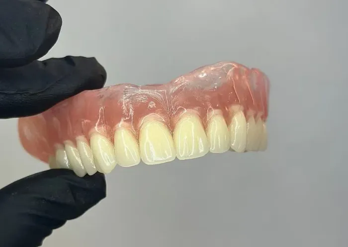 Prótese dentária