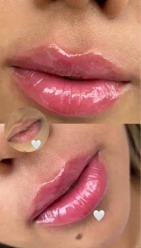 Hydra Gloss lips a domicílio