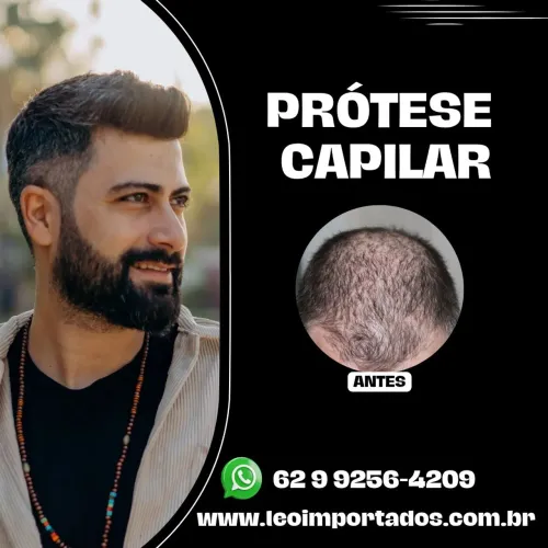 Prótese Capilar Masculina Micropele No Duplo