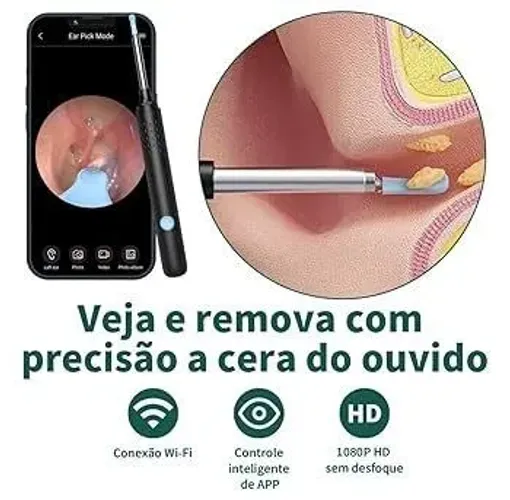 Limpeza de ouvido com câmera