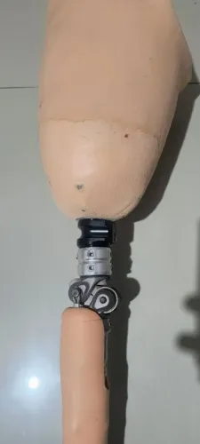 Prótese de joelho