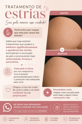 Tratamento para estrias e cicatrizes!