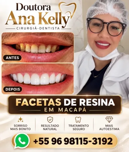 Facetas