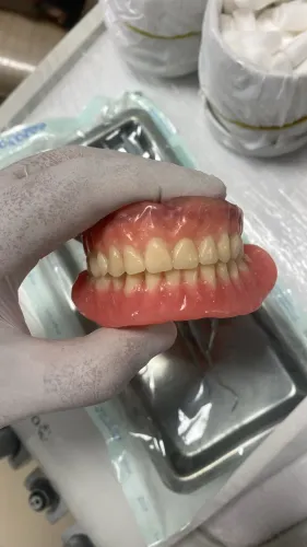 Protese dentaria / dentadura