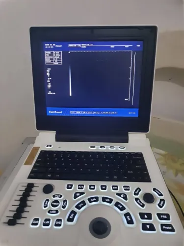 Ultrasson ultrasound