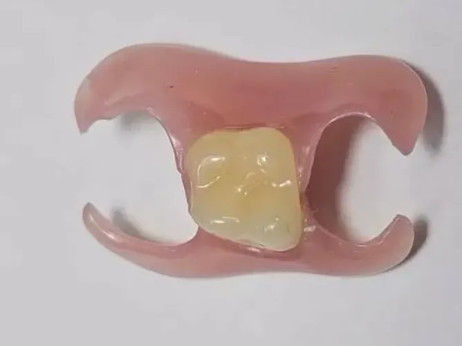 Prótese Flexível (Flex)
