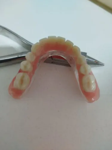 Prótese dentária