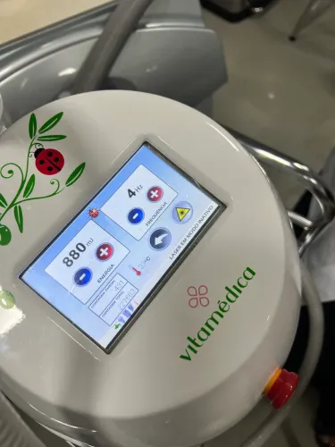 Laser para remoção de micropigmentação e tatuagem