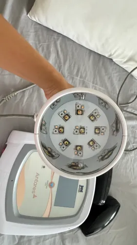 Antares ibramed laser /lad