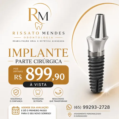 Implantes dentario