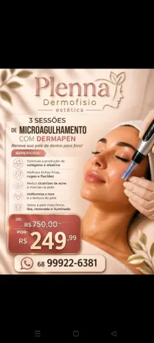 Microagulhamento 