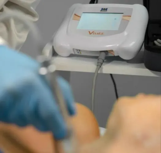 Ultrasson Microfocado Visage