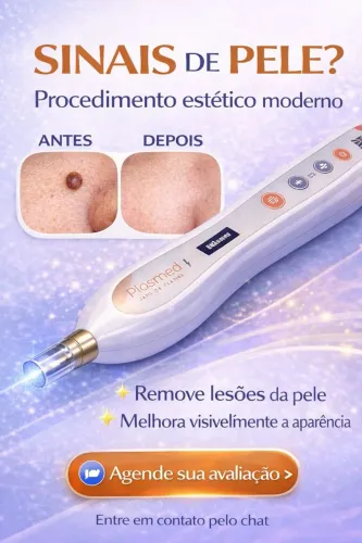 Retirada de sinais de pele sem cirurgia | Avaliação estética