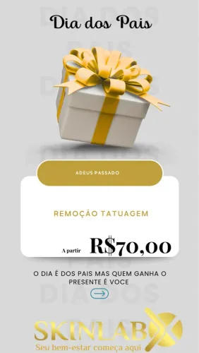 Remoção de Tatuagem - Dia dos Pais