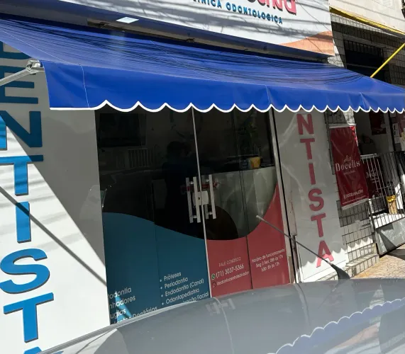 Toldo Retrátil para comércio 