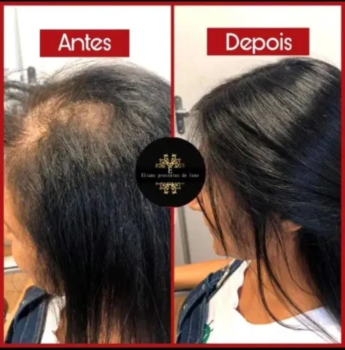 Topos de cabelo 100% humano brasileiro.