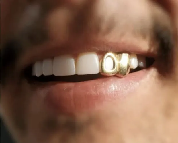 Dente de ouro/Prata Grillz