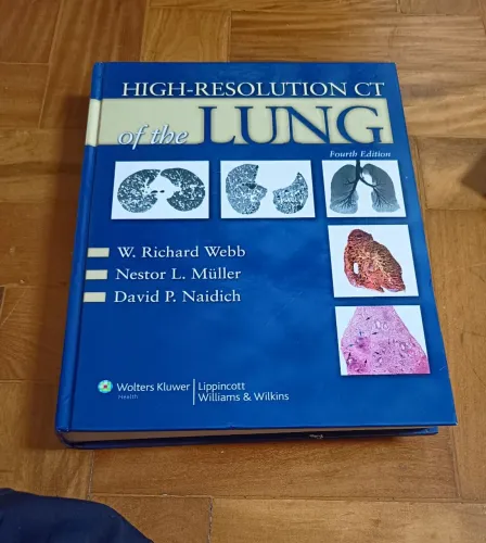 Livro High-Resolution CT of the Lung - W. Richard Webb - Medicina, Pulmão, Cirurgião, Saúd