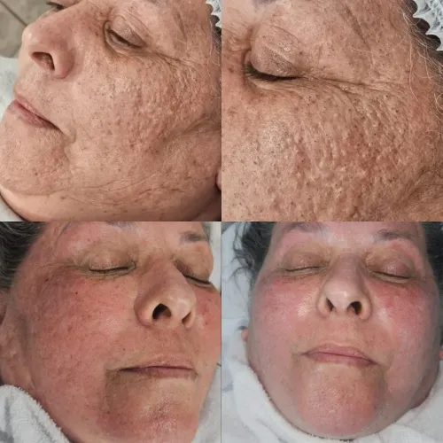 Limpeza de Pele e Depilação a domicílio 