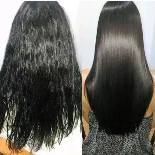 Selagem Térmica +Botox