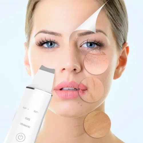 Aparelho Ultrassônico Peeling Facial Removedor Cravos Acne