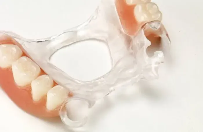 Prótese Dentária Removível - Conforto e Estética