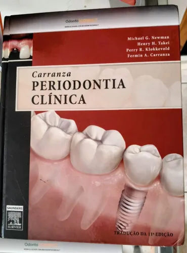 Periodontia Clínica 11.ª edição - CARRANZA