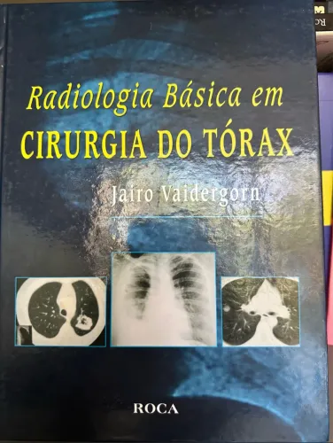 Livro radiologia básica em cirurgia do tórax 