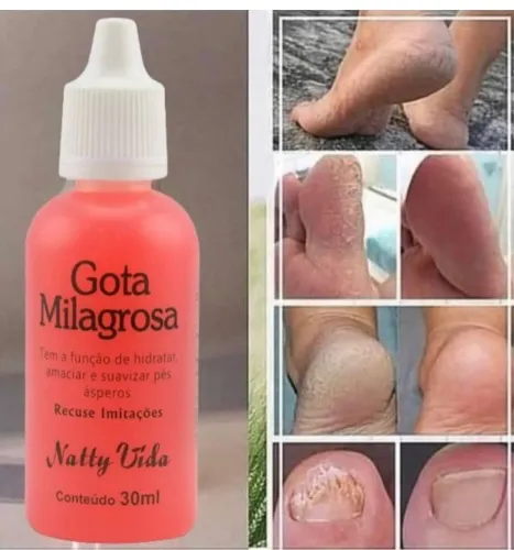 GOTA MILAGROSA