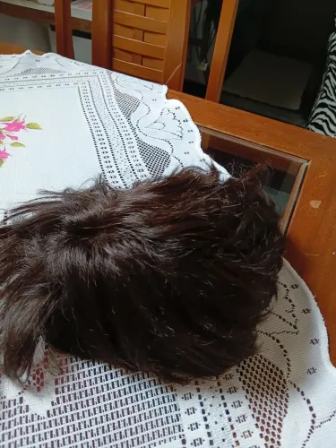 Prótese capilar