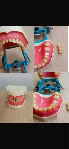 Profissional Protético 