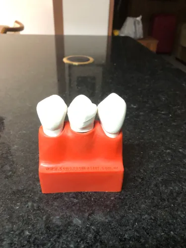 Macromodelo dentário de cáries e implante