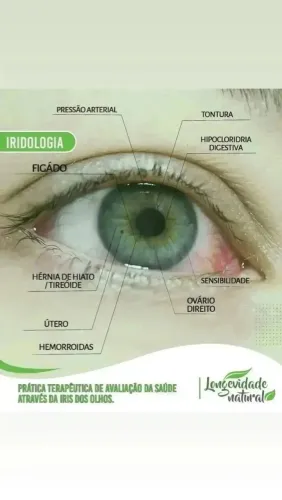 Consultas de Iridologia e Naturopatia!