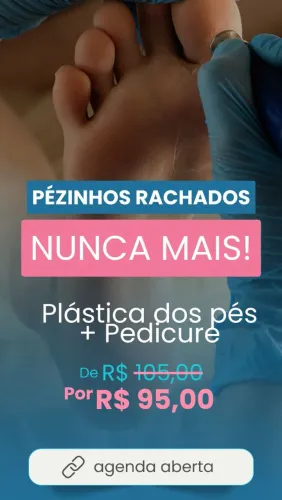 Plástica dos pés 