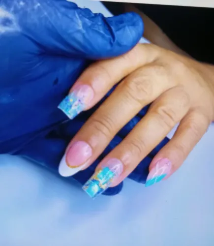 Unhas