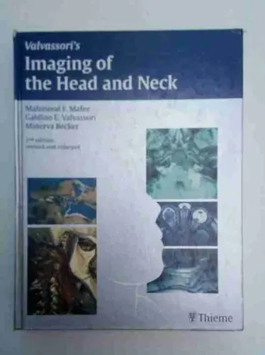 Valvassori's Imaging of Head and Neck