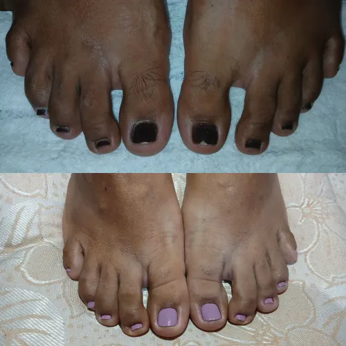 Manicure e pedicure a domicilio.